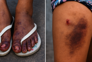 Mulher de 31 anos acusa ex-marido e outros homens de agressão e estupro coletivo em Vitória